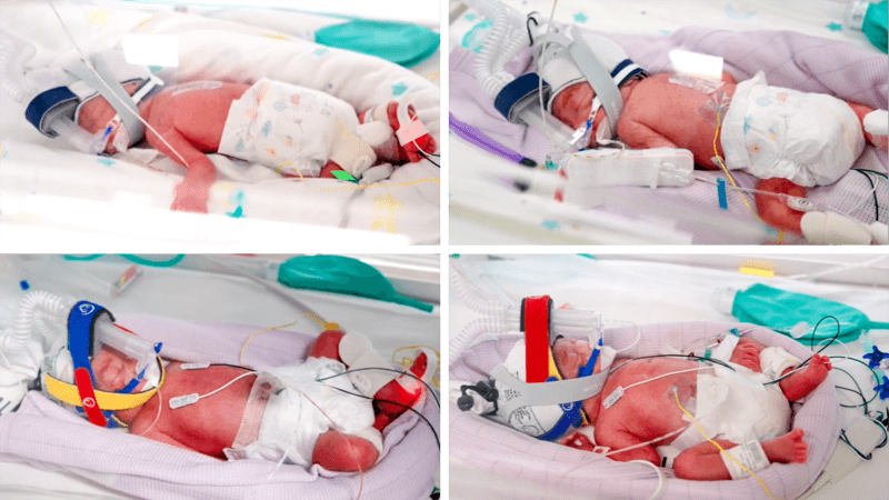 Rare identical quadruplets born in Australia